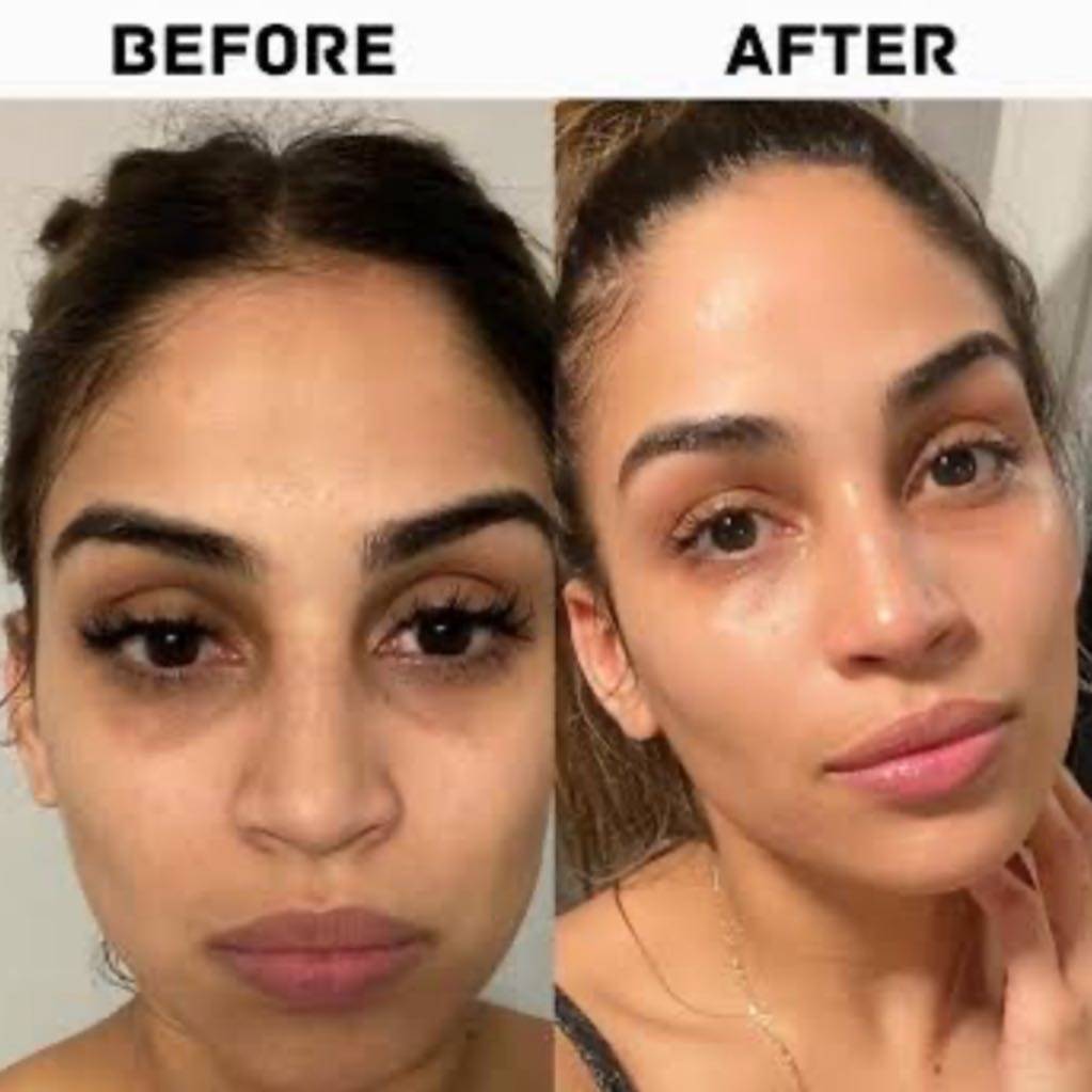 The ordinary caffeine solution serum سیرەمی کافێین سۆڵوشنی ئۆردینەری بۆ دەوری چاو