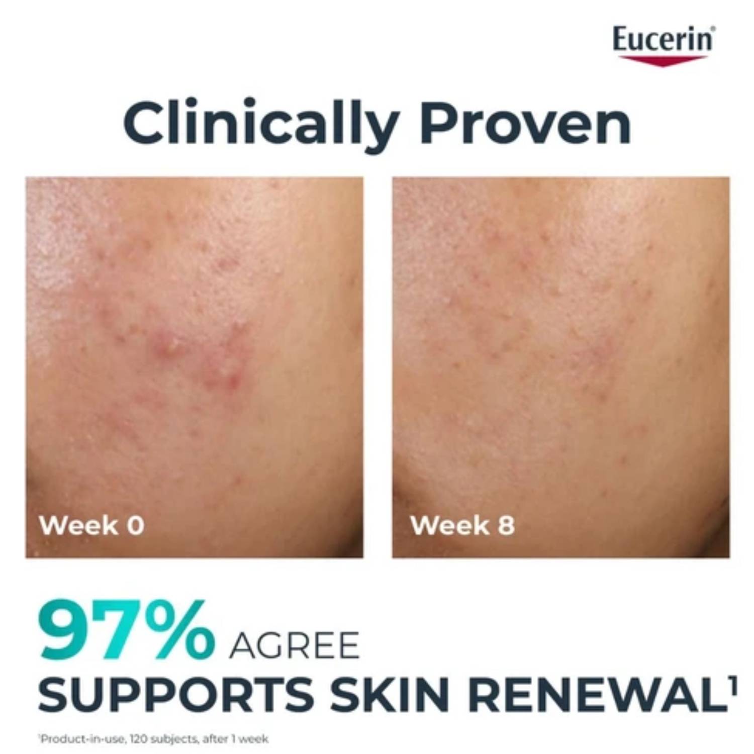 Eucerin dermopurphy oil control moisturizer شێدارکەرەوەی کۆنترۆڵکەری چەوری ئیوسرین