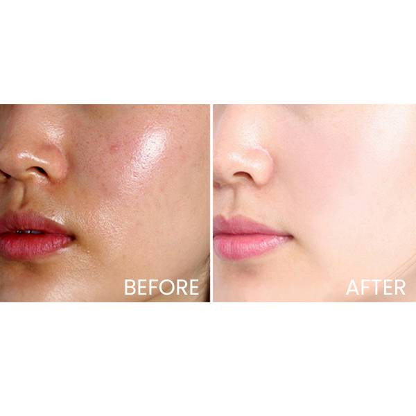 Vichy Normaderm Phytosolution Intensive Purifying Gel غسولی پاکەرەوەی چڕی کۆنترۆڵکەری چەوری ڤیچی 